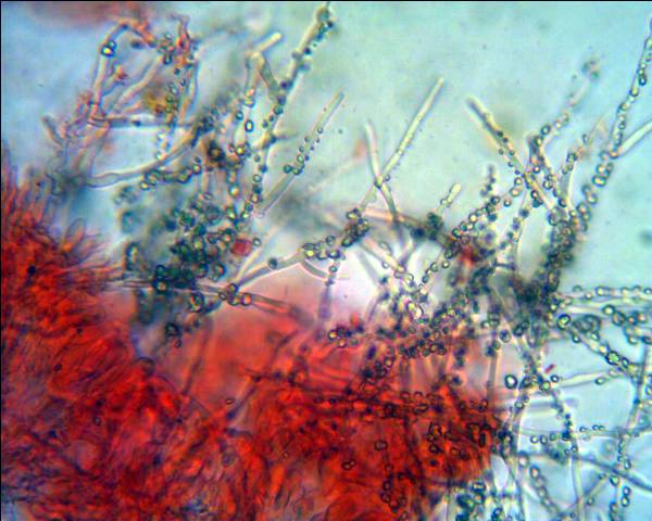 Corticiacea da determinare (Hyphodontia juniperi)